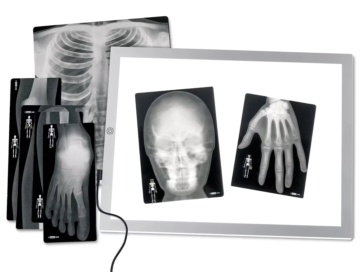 Human X-Rays - Set of 18 - US 6260