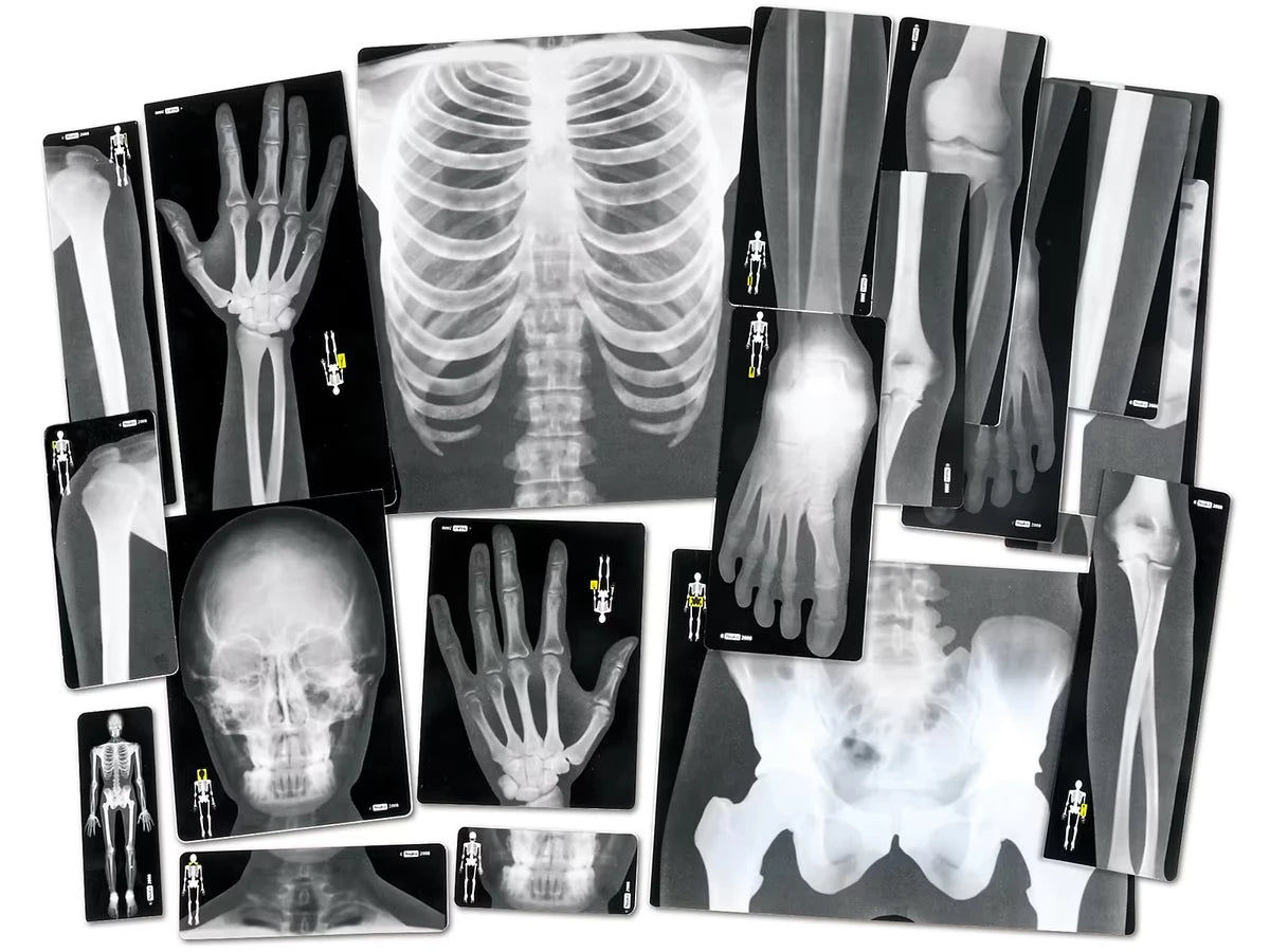Human X-Rays - Set of 18 - US 6260