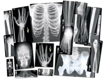 Human X-Rays - Set of 18 - US 6260