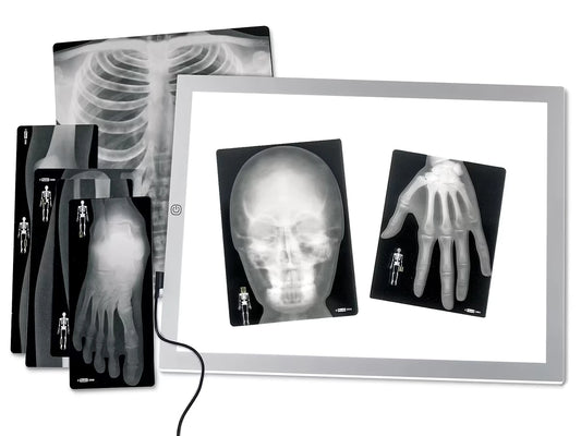 Human X-Rays - Set of 18 - US 6260